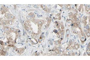 ABIN6279042 at 1/100 staining Human prostate tissue by IHC-P. (RPL24 抗体  (Internal Region))