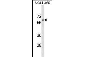 PGM5 Antibody (C-term) (ABIN1537280 and ABIN2849179) western blot analysis in NCI- cell line lysates (35 μg/lane). (Phosphoglucomutase 5 抗体  (C-Term))