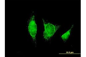 Immunofluorescence of purified MaxPab antibody to ADH1B on HeLa cell. (ADH1B 抗体  (AA 1-375))