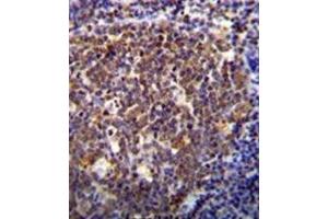 Immunohistochemistry analysis in formalin fixed and paraffin embedded human tonsil tissue reacted with HOXB6 / HOX2B Antibody (Center) followed  which was peroxidase-conjugated to the secondary antibody, followed by DAB staining. (HOXB6 抗体  (Middle Region))