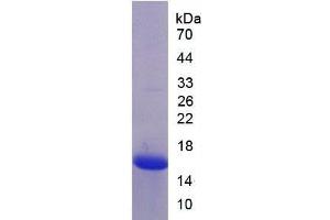 SDS-PAGE of Protein Standard from the Kit (Highly purified E. (MASP2 ELISA 试剂盒)