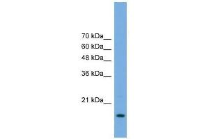 POP5 antibody used at 0. (POP5 抗体  (Middle Region))