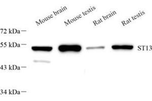 Western blot analysis of ST13 (ABIN7075761),at dilution of 1: 2000