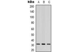 Western blot analysis of CBR3 expression in K562 (A), MCF7 (B), Hela (C) whole cell lysates. (CBR3 抗体)