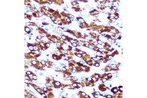 Immunohistochemistry of paraffin-embedded human liver using SERPINC1 Rabbit mAb (ABIN7270208) at dilution of 1:100 (40x lens). (SERPINC1 抗体)
