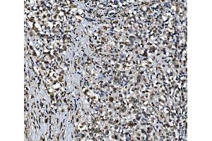 IHC analysis of CDC27 using anti-CDC27 antibody (ABIN7602163).