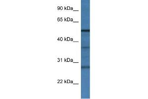 WB Suggested Anti-Rnf14 Antibody   Titration: 1. (RNF14 抗体  (N-Term))