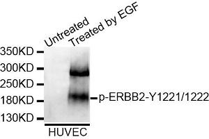 Western blot analysis of extracts of HUVEC cell line, using Phospho-ERBB2-Y1221/1222 antibody. (ErbB2/Her2 抗体  (pTyr1221, pTyr1222))