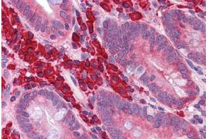 Human Small Intestine: Formalin-Fixed, Paraffin-Embedded (FFPE) (FOXO4 抗体  (N-Term))