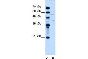 WB Suggested Anti-DHODH Antibody Titration:  2. (DHODH 抗体  (N-Term))