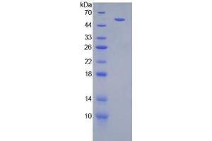 SDS-PAGE analysis of Mouse IFNgR1 Protein.