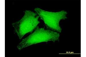 Immunofluorescence of purified MaxPab antibody to RPUSD3 on HeLa cell. (RPUSD3 抗体  (AA 1-343))
