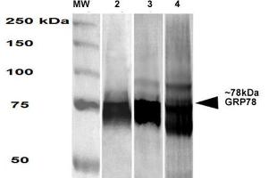Western Blot analysis of Human, Mouse, Rat HEK-293, NIH3T3, and Rat Brain cell lysates showing detection of GRP78 protein using Mouse Anti-GRP78 Monoclonal Antibody, Clone 3G12-1G11 . (GRP78 抗体  (PE))