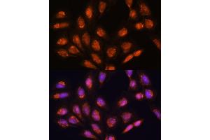 Immunofluorescence analysis of U-2 OS cells using TIMM44 antibody (ABIN7270927) at dilution of 1:100. (TIMM44 抗体  (AA 153-452))