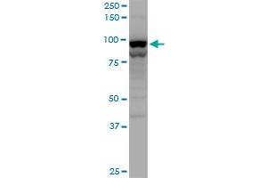 TNPO2 polyclonal antibody (A01), Lot # 060619JCS1. (TNPO2 抗体  (AA 201-300))