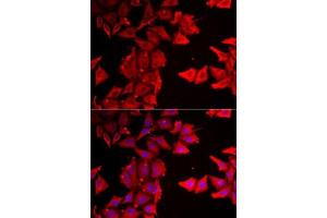 Immunofluorescence analysis of MCF7 cells using THRSP antibody (ABIN6129590, ABIN6149129, ABIN6149130 and ABIN6223067). (THRSP 抗体  (AA 1-146))