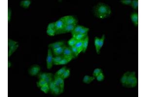 Immunofluorescence staining of HepG2 cells with ABIN7170211 at 1:133, counter-stained with DAPI. (SLC26A6 抗体  (AA 554-668))