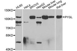 Western blot analysis of extracts of various cell lines, using PYGL antibody. (PYGL 抗体  (AA 1-280))