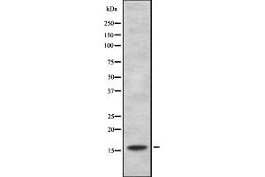 Western blot analysis of HSPB3 expression in HEK293 cells ,The lane on the left is treated with the antigen-specific peptide. (HSPB3 抗体  (Internal Region))