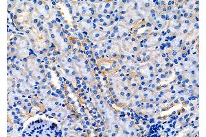 ABIN6260359 and ABIN6278045 at 1/100 staining Rat kidney tissue by IHC-P.