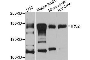 Western blot analysis of extracts of various cell lines, using IRS2 antibody (ABIN5974770) at 1/1000 dilution. (IRS2 抗体)