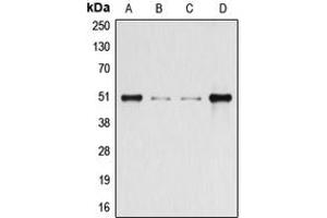 Western blot analysis of Beta-arrestin-1 (pS412) expression in HeLa (A), HEK293T (B), Raw264. (beta Arrestin 1 抗体  (C-Term, pSer412))