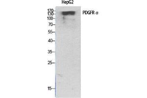 Western Blot (WB) analysis of specific cells using PDGFR-alpha Polyclonal Antibody. (PDGFRA 抗体  (C-Term))