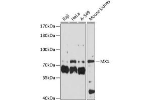 Western blot analysis of extracts of various cell lines, using MX1 antibody (ABIN3022532, ABIN3022533, ABIN3022534 and ABIN6218886) at 1:3000 dilution. (MX1 抗体  (AA 368-662))
