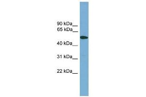 TMPRSS4 antibody used at 1 ug/ml to detect target protein. (TMPRSS4 抗体  (Middle Region))
