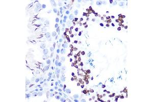 Immunohistochemistry of paraffin-embedded rat testis using Phospho-ST-S727 Rabbit mAb (ABIN7270300) at dilution of 1:100 (40x lens). (STAT1 抗体  (pSer727))