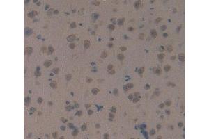 IHC-P analysis of brain tissue, with DAB staining. (MAP1B 抗体  (AA 2203-2464))