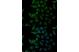 Immunofluorescence analysis of U2OS cells using PLOD2 antibody (ABIN5974174). (PLOD2 抗体)