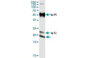 Immunoprecipitation of IFNE transfected lysate using anti-IFNE MaxPab rabbit polyclonal antibody and Protein A Magnetic Bead , and immunoblotted with IFNE MaxPab rabbit polyclonal antibody (D01) . (IFNE 抗体  (AA 1-208))