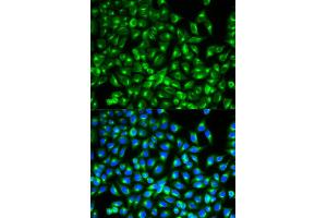 Immunofluorescence analysis of MCF-7 cells using CDC34 antibody. (CDC34 抗体)