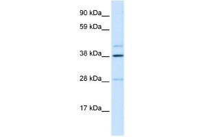 WB Suggested Anti-LASS3 Antibody Titration: 0.
