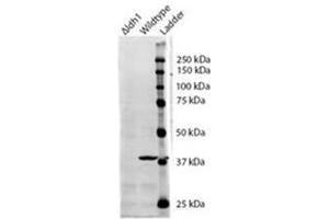 AP31099PU-N IDH1 antibody staining of S. (IDH1 抗体  (Internal Region))