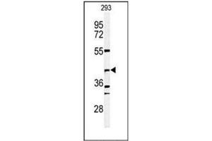 Western blot analysis of DFFB / CAD Antibody (N-term) in 293 cell line lysates (35ug/lane). (DFFB 抗体  (N-Term))