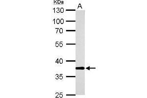 WB Image AKR1B10 antibody detects AKR1B10 protein by Western blot analysis.