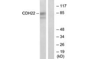 Western Blotting (WB) image for anti-Cadherin-Like 22 (CDH22) (AA 111-160) antibody (ABIN2889882) (CDH22 抗体  (AA 111-160))