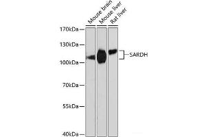 Western blot analysis of extracts of various cell lines using SARDH Polyclonal Antibody at dilution of 1:3000. (SARDH 抗体)