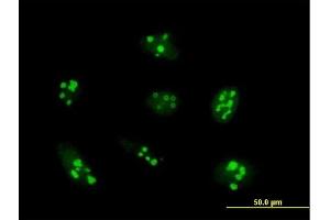 Immunofluorescence of purified MaxPab antibody to UTP14A on HeLa cell. (UTP14A 抗体  (AA 1-771))