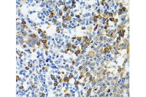 Immunohistochemistry of paraffin-embedded Human tonsil using HYOU1 Polyclonal Antibody at dilution of 1:100 (40x lens). (HYOU1 抗体)
