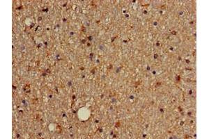 Immunohistochemistry of paraffin-embedded human brain tissue using ABIN7172631 at dilution of 1:100 (SOX4 抗体  (AA 1-60))