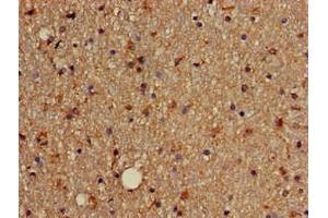 Immunohistochemistry of paraffin-embedded human brain tissue using ABIN7172631 at dilution of 1:100 (SOX4 抗体  (AA 1-60))