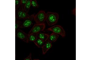 Immunofluorescence (IF) image for anti-Antigen Identified By Monoclonal Antibody Ki-67 (MKI67) (AA 2293-2478) antibody (ABIN6940053)