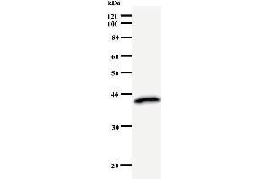 Western Blotting (WB) image for anti-RuvB-Like 1 (E. Coli) (RUVBL1) antibody (ABIN932457) (RUVBL1 抗体)