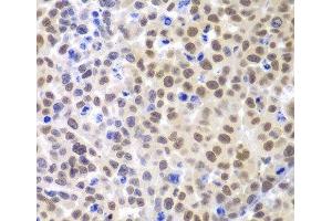 Immunohistochemistry of paraffin-embedded Mouse cancer using LHX4 Polyclonal Antibody at dilution of 1:100 (40x lens). (LHX4 抗体)