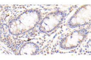 Immunohistochemistry (IHC) image for anti-NEDD8 Activating Enzyme E1 Subunit 1 (NAE1) (AA 229-534) antibody (ABIN7444856)