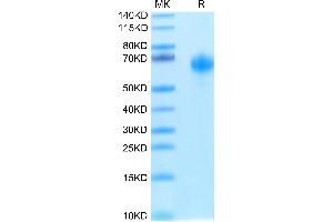Biotinylated Human IL-1R3 on Tris-Bis PAGE under reduced condition. (IL1RAP Protein (His-Avi Tag,Biotin))