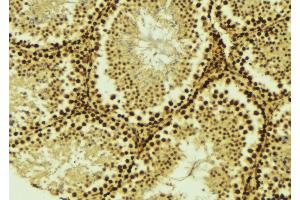 ABIN6275529 at 1/100 staining Mouse testis tissue by IHC-P. (STK36 抗体  (Internal Region))